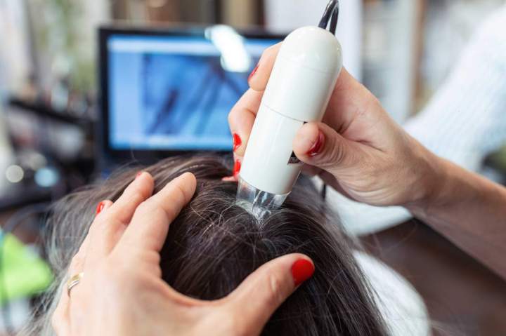 Analyse capillaire Montpellier